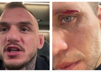 Renato Moicano Claims Brian Ortega Is ‘Not In A Good Place Mentally’ Following UFC 331 Pullout